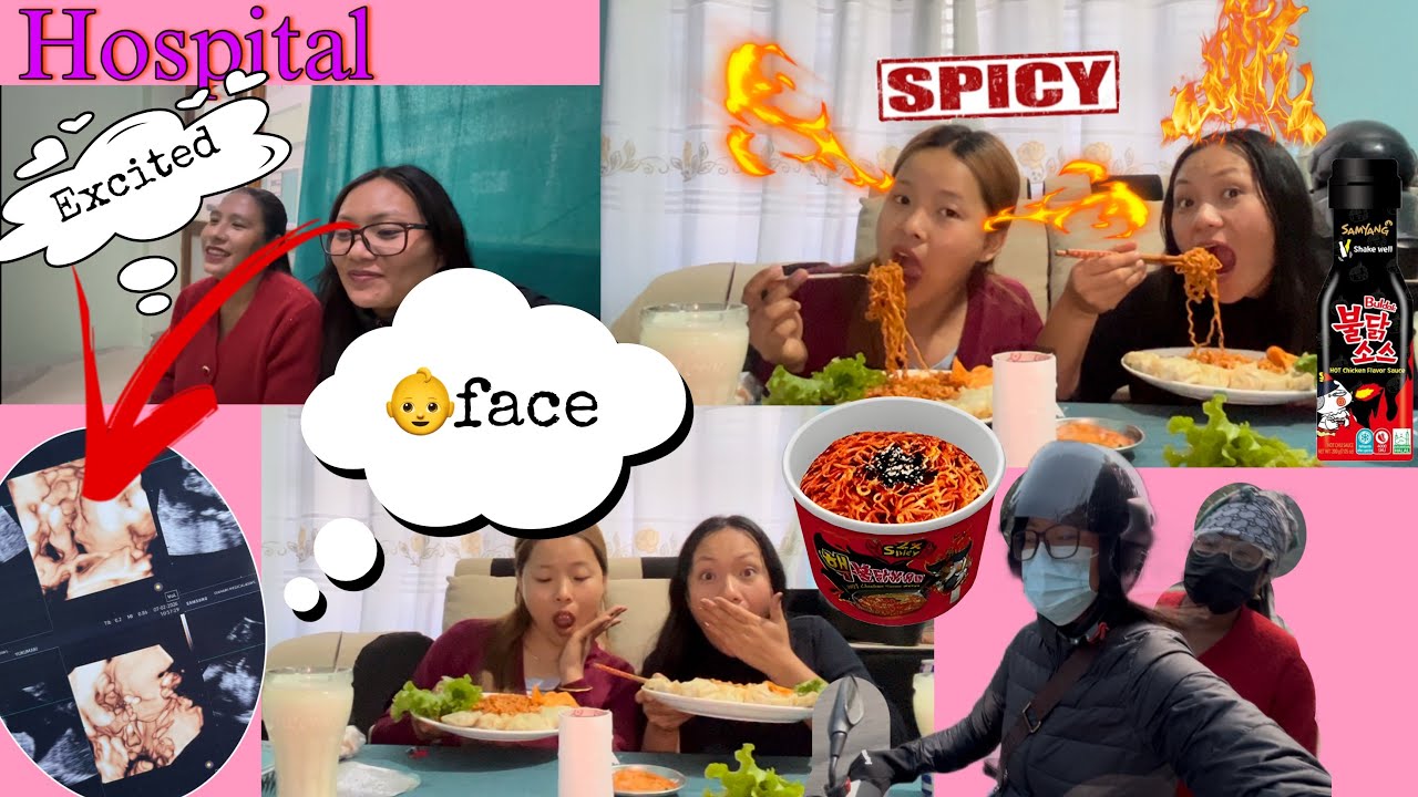 HOSPITAL VISIT ✅ ||| BULDAK NOODLES 🍝 MUKBANG||🥵🥵🔥🔥@Samikshyarai1233 