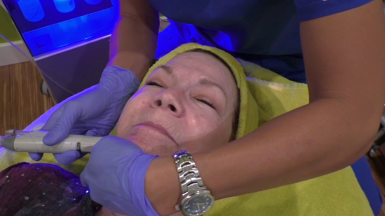 Hydrafacial Infusion with Peptides