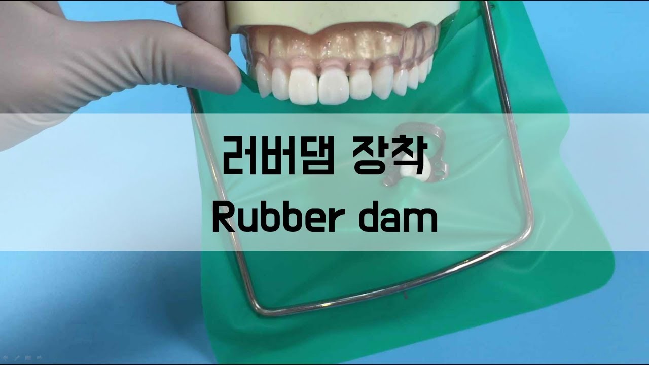 러버댐 장착(Rubber dam) - 치과위생사 실습 실기 ! 치과굿잡!