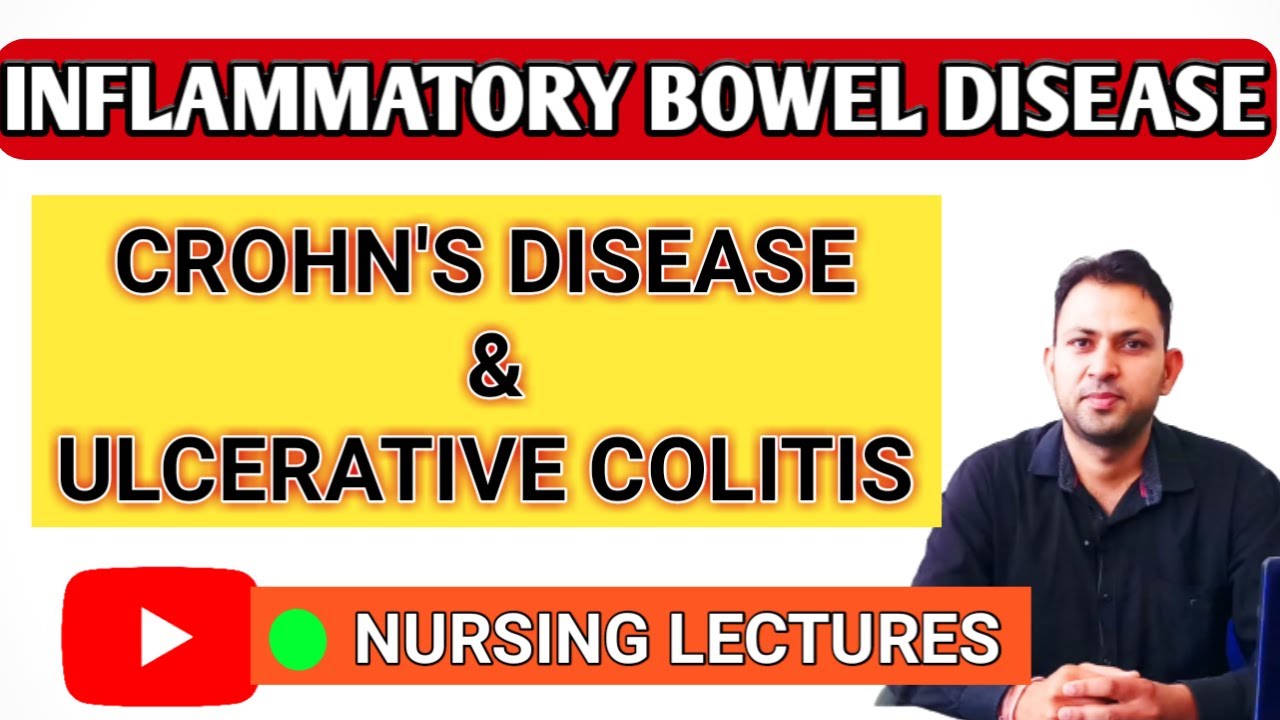 INFLAMMATORY BOWEL DISEASE (Hindi) | CROHN'S DISEASE | ULCERATIVE COLITIS | NURSES TECH ONLINE