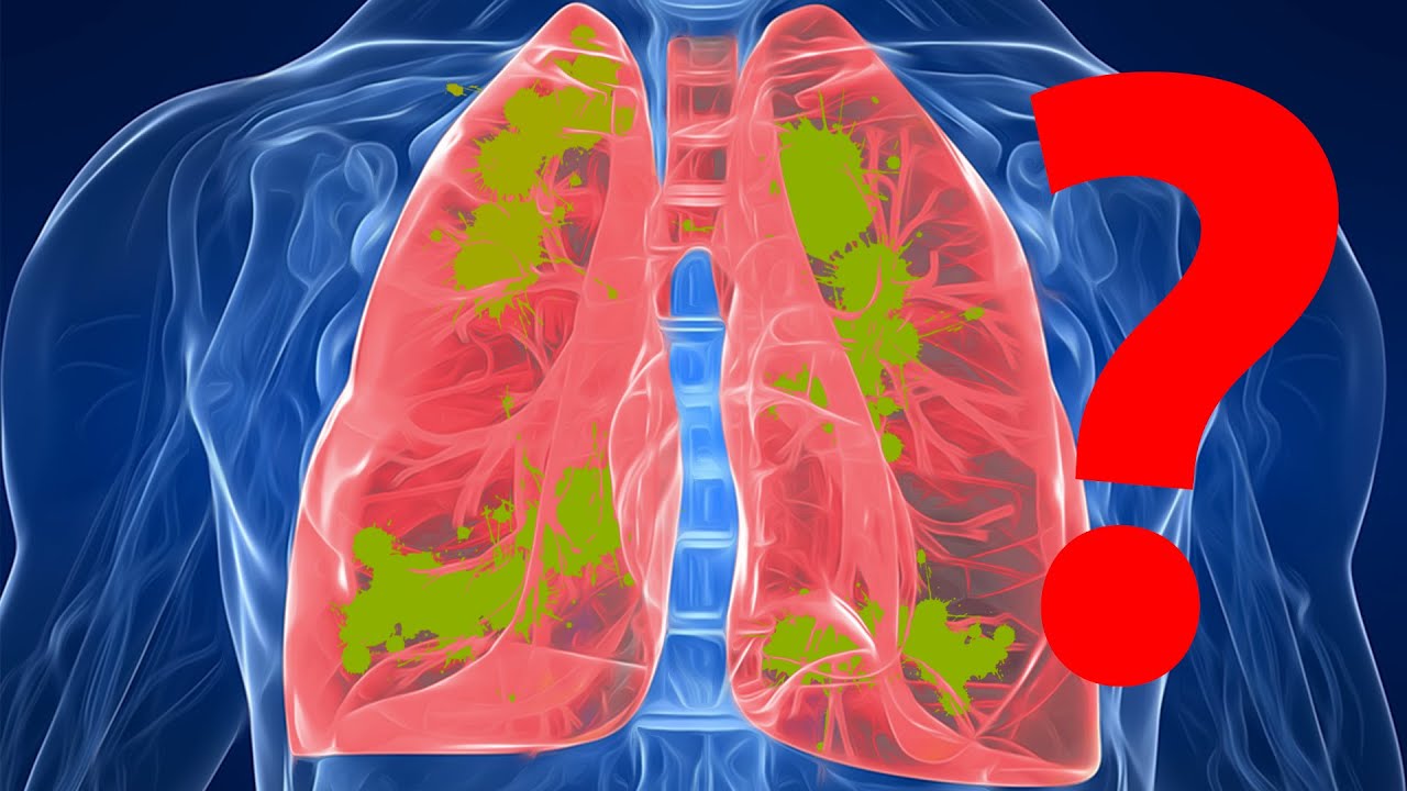 Fibrosi cistica: solo i polmoni o c'è altro? - Spiegazione