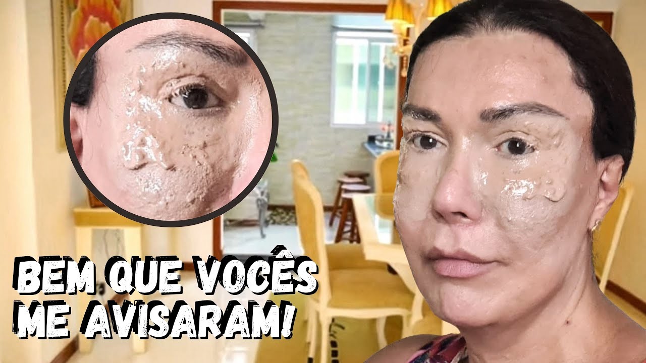 FIQUEI PREOCUPADA COM MEUS OLHOS! | JOANNA MARIA, A CAPIXABA NA ISLÂNDIA