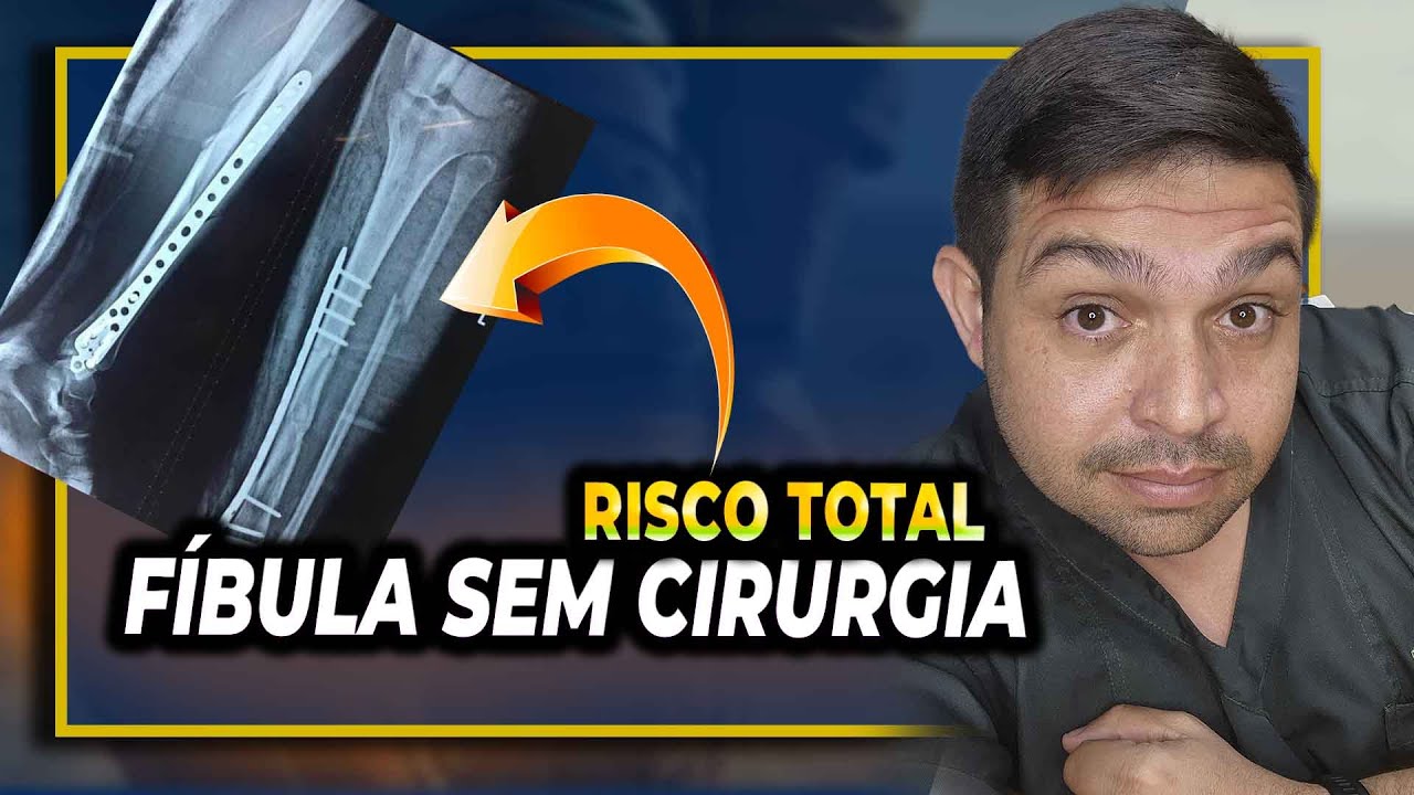 Fratura de Fíbula Sem Cirurgia Isso é Seguro?