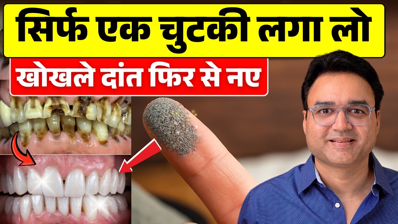 ये आयुर्वेदिक दन्त मंजन लगा लो - कीड़ा लगे, पीले, खोखले दांत फिर से नए कर देगा | Teeth Cavity