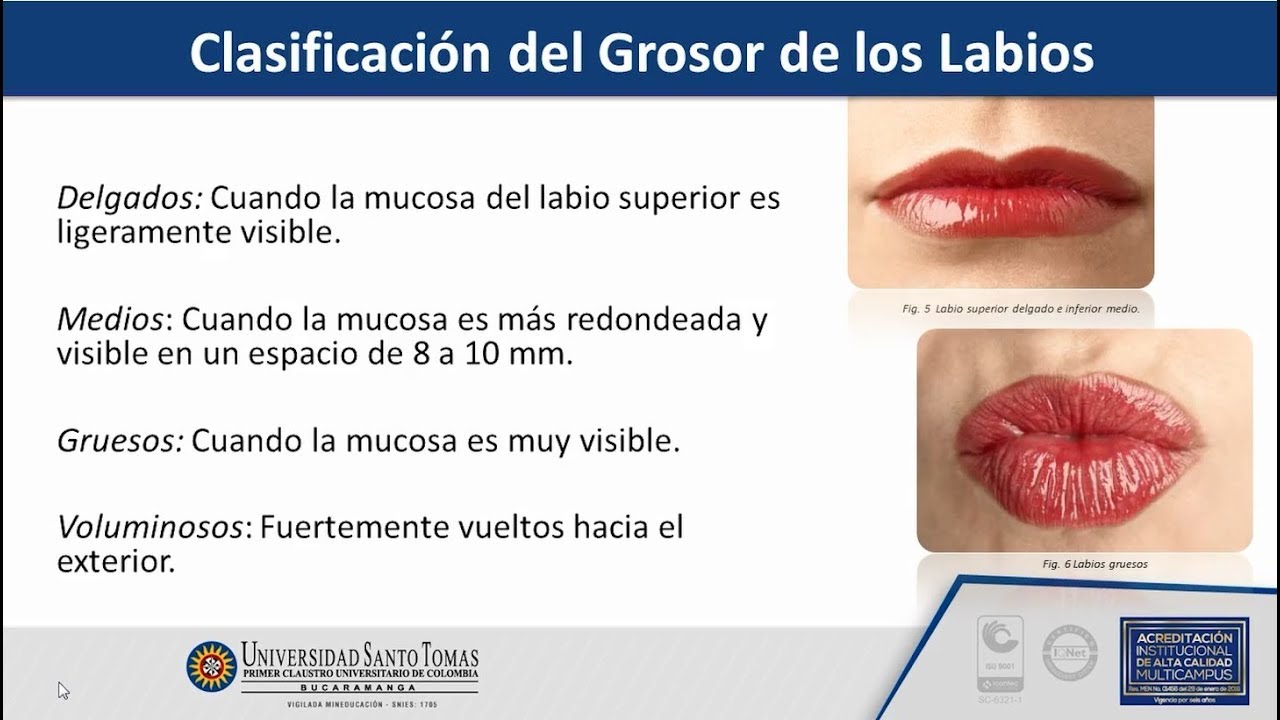 Método Queiloscopia USTABuca
