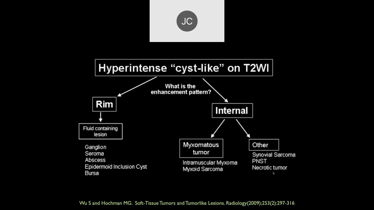 MRI of Soft Tissue Tumors | Part 1