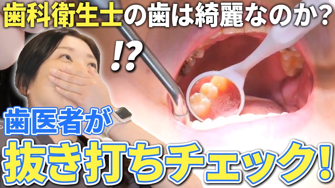 虫歯は本当にないのか？歯医者が歯科衛生士の口腔内を抜き打ちチェック！