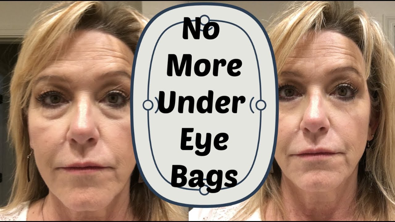 No More Under Eye Bags! (OVER 50)