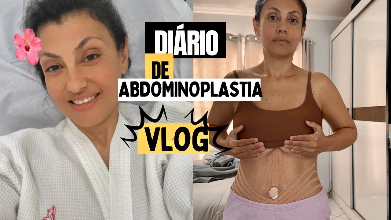 😅MOSTREI A BARRIGA SEM CURATIVOS, sigo sem banho🛁 mudei o tamanho da cinta !! Não consigo dormir 