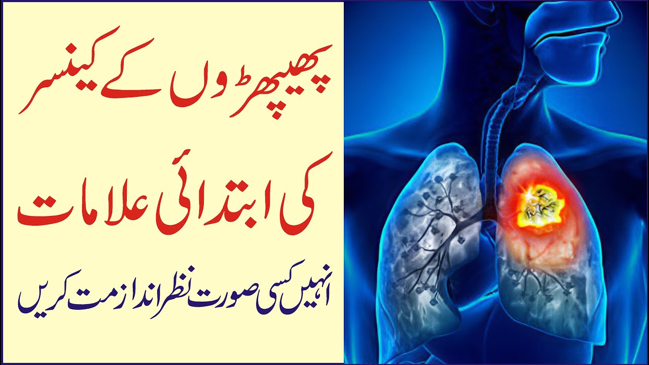 Early Warning Signs of Lung Cancer Urdu Hindi || lung cancer symptoms || Stay Healthy
