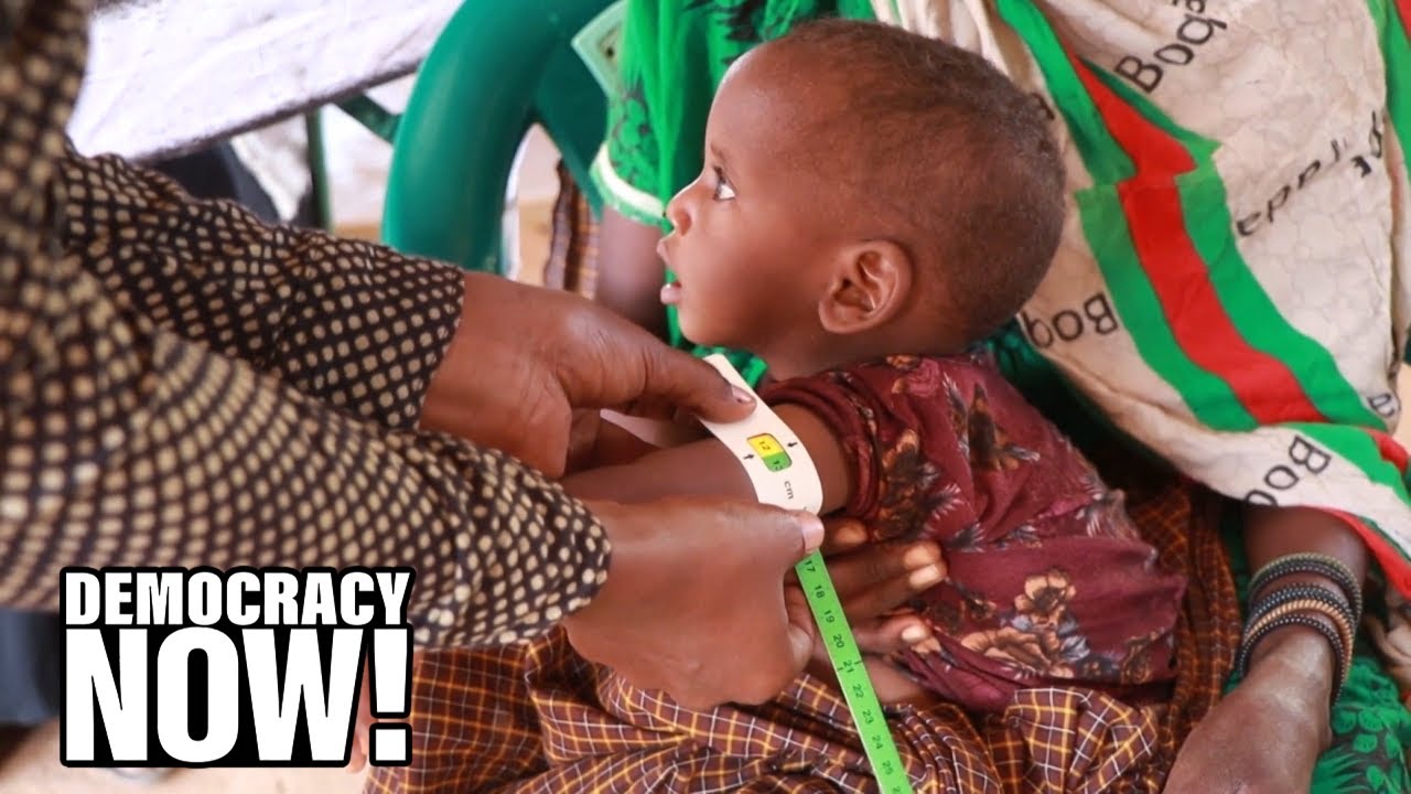 COVID, Climate & Conflict Fueling Global Hunger as World Leaders at U.N. Urged to Take Action