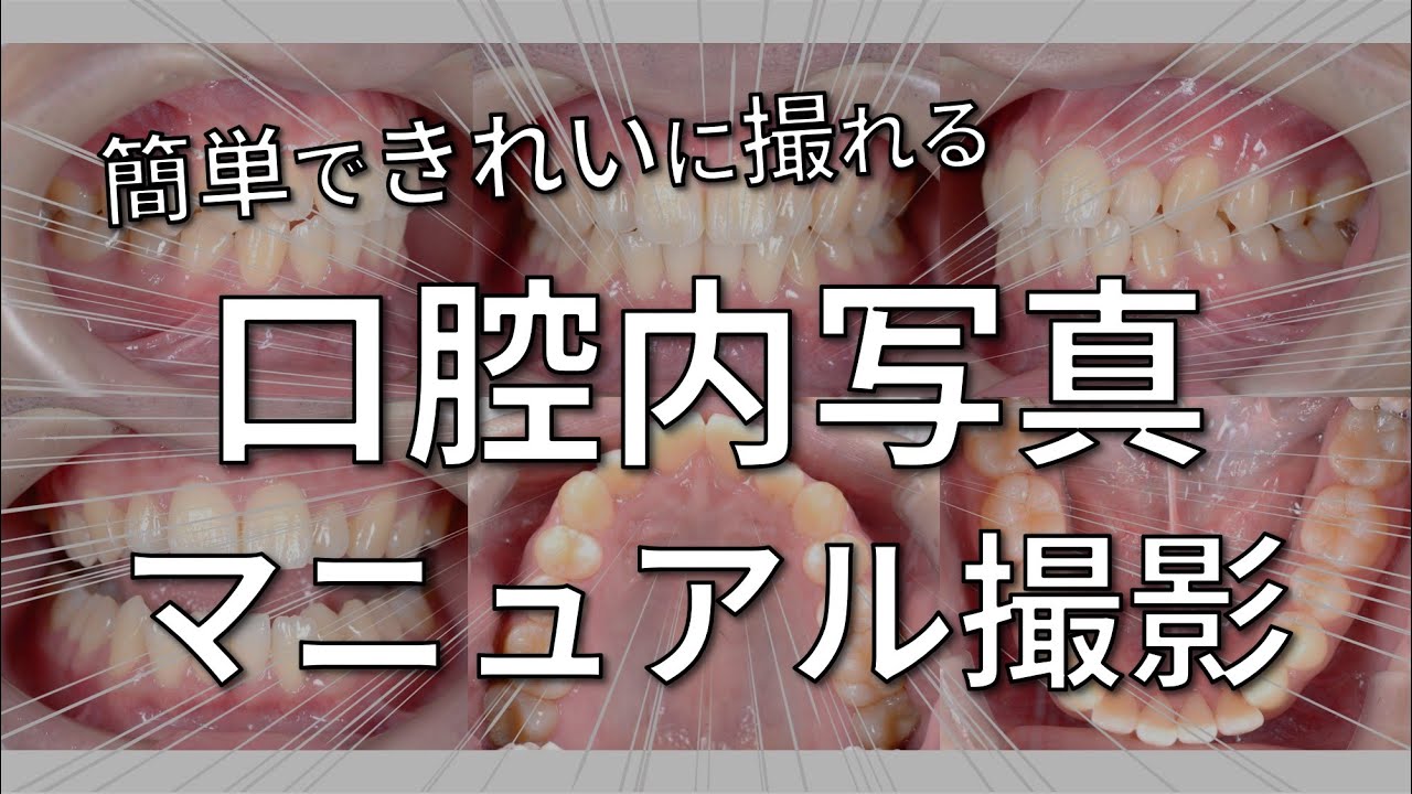 口腔内写真のマニュアル撮影を理解しよう
