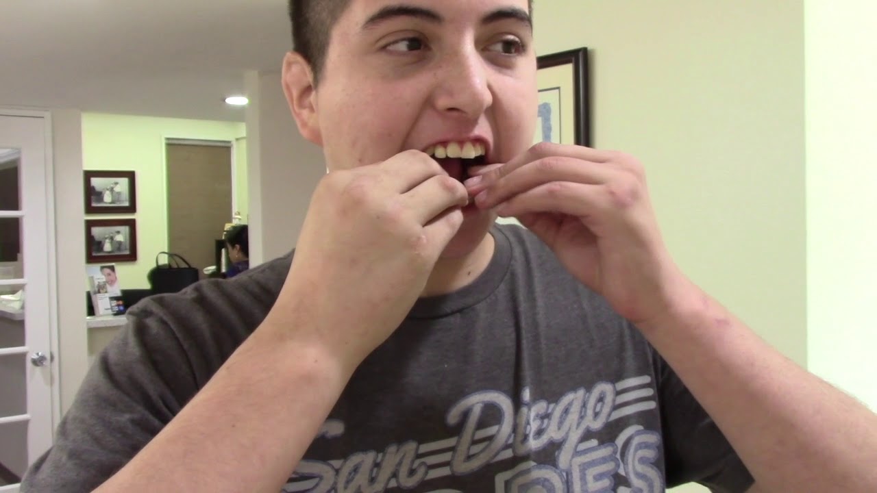 New treatment, Tourettes Tics cease, Dr. Demerjian TMJCONNECTION.COM