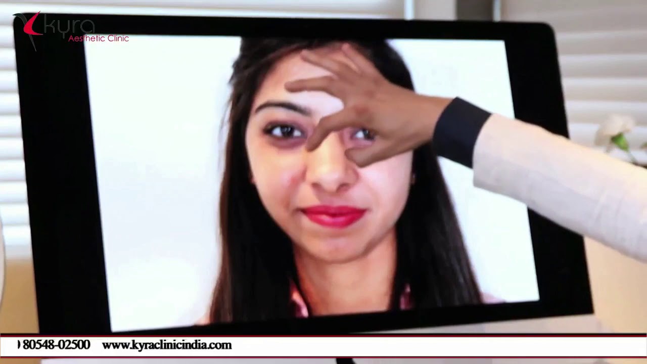 Cost of Rhinoplasty in Chandigarh | Rhinoplasty in Ludhiana Punjab Dr Vikas Gawri