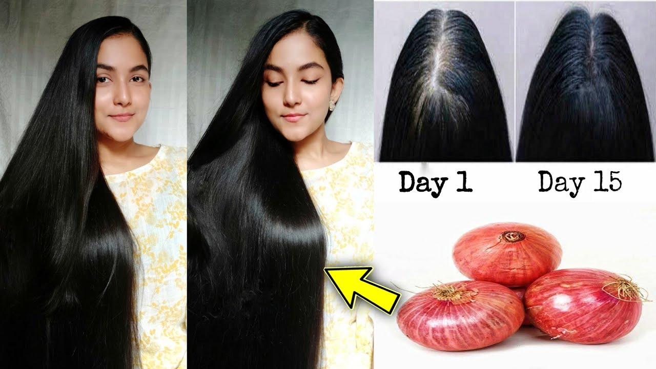 মাত্র ১৫ দিনে চুল ঘন করতে ও নতুন চুল গজাতে ১০০% কার্যকরী উপায় || 15 Days Hair Regrowth Challenge