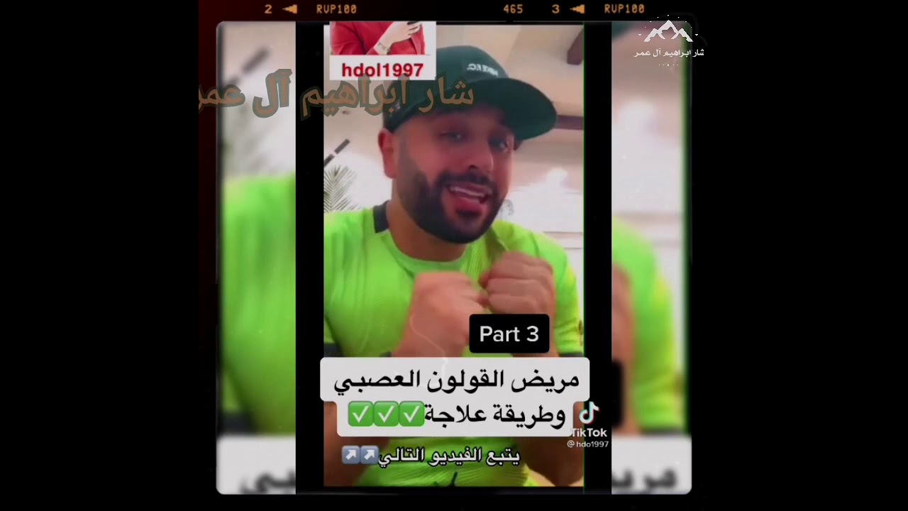 علاج القولون العصبي