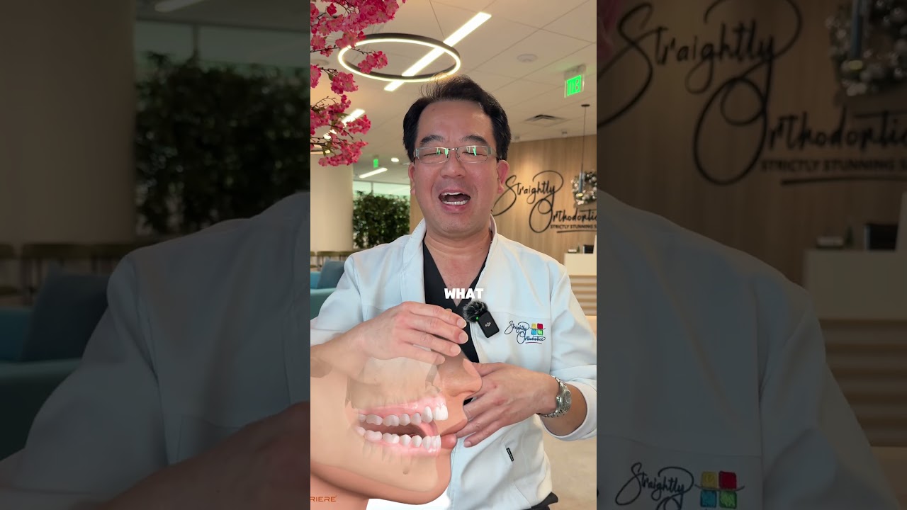 Does your child have “shark teeth?” 🦈 🦷 #orthodontist #sharkteeth
