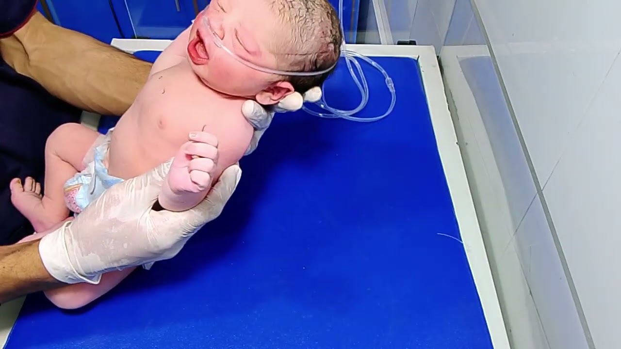 🫁 RDS Baby NICU Care (Respiratory Distress Syndrome)