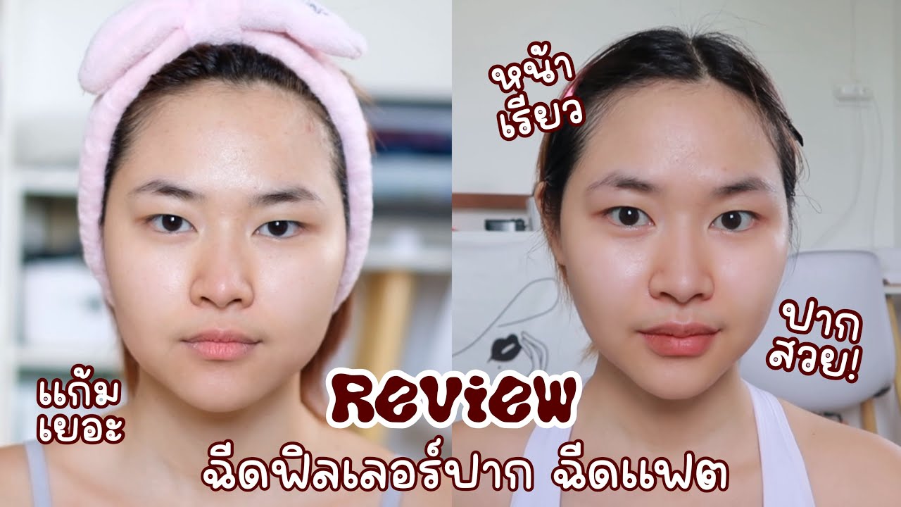 ครั้งแรกของฉัน!! ฉีดฟิลเลอร์ปาก ฉีดแฟต  หน้าเรียวปากสวย มีแต่คนชมว่าปัง !