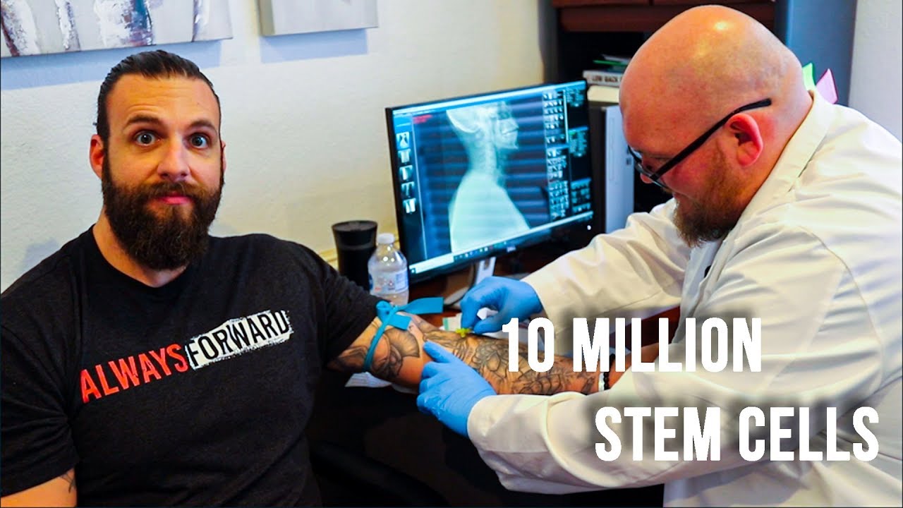 I GOT 10 MILLION STEM CELLS INJECTED | Nick Koumalatsos