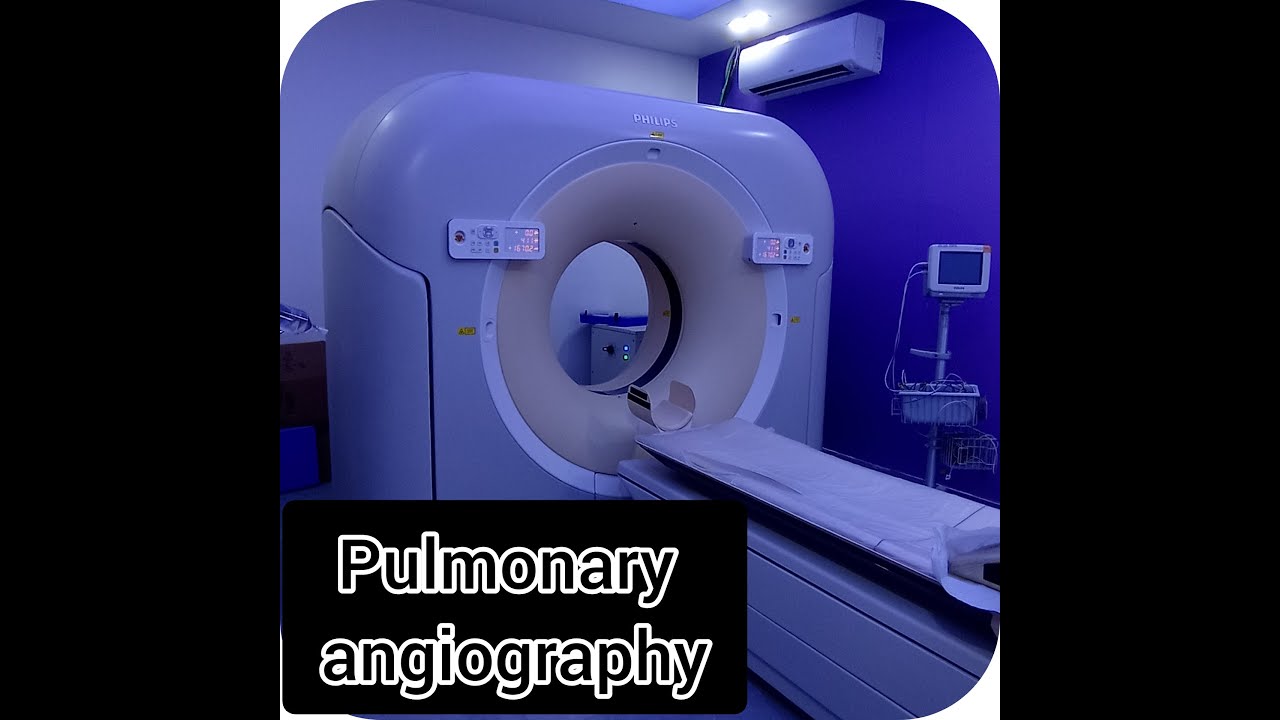 CT pulmonary angiography with bolus track