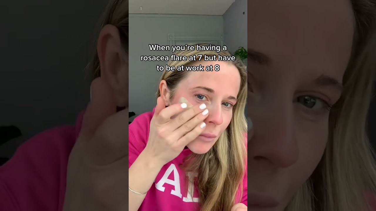 Do you know this hack for Rosacea? Green makeup and primer minimizes the appearance of red #rosacea