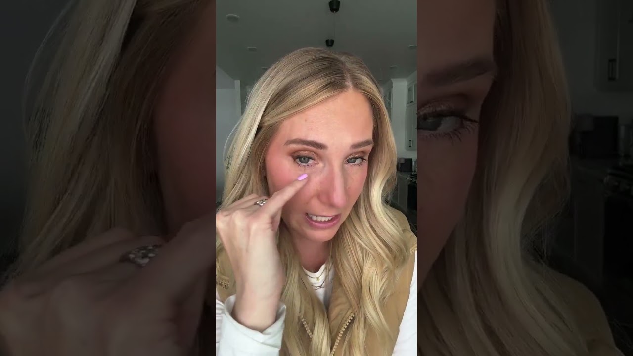 Color correcting undereye bags and discoloration