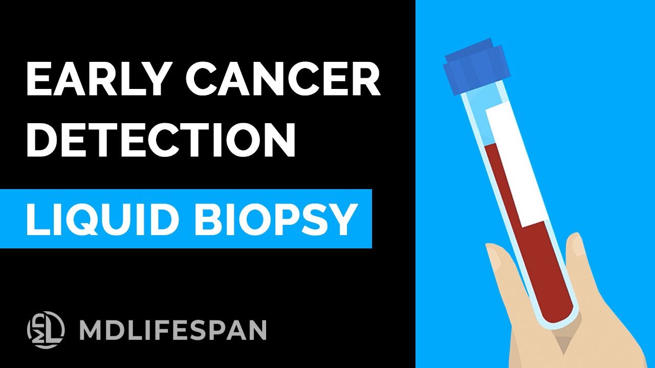 Early Cancer Detection Blood Test - Liquid Biopsy