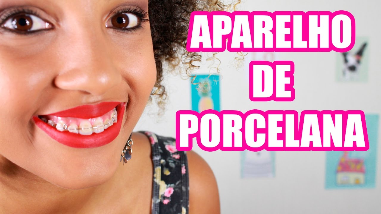 Meu aparelho de porcelana | Aparelho estético