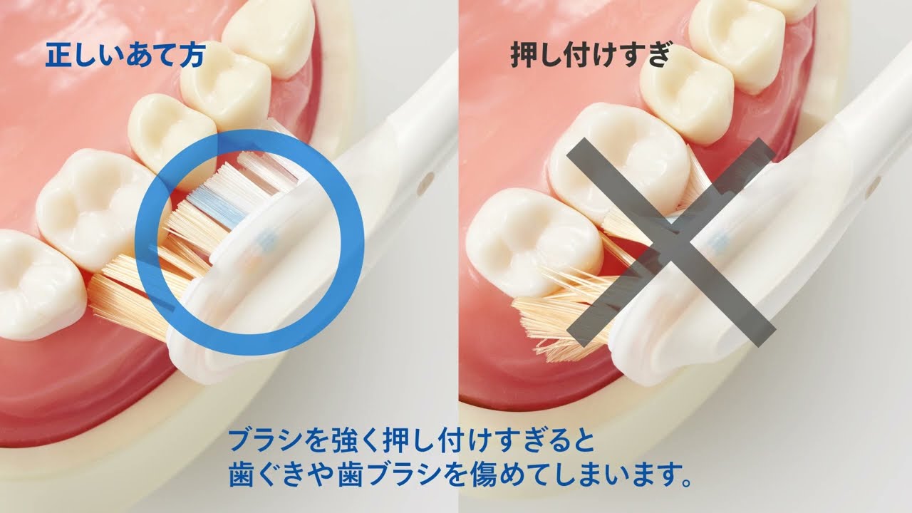 ソニッケアーの基本的な磨き方