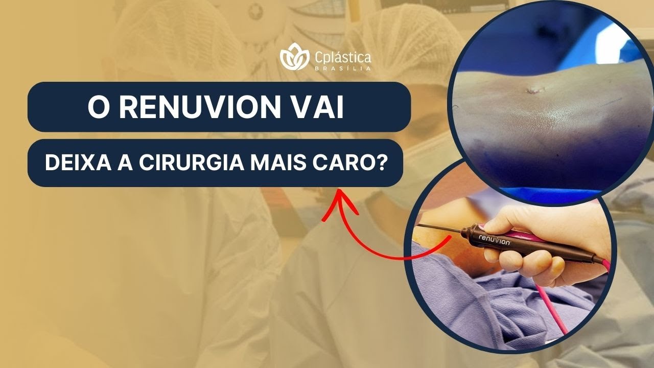 RENUVION AUMENTA O PREÇO DA CIRURGIA?│Dr.Cristian e Dra.Raquel