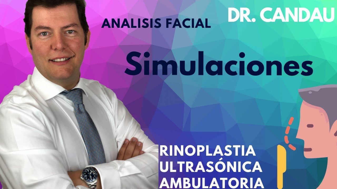 Simulacion Rinoplastia Ultrasónica - Dr Candau