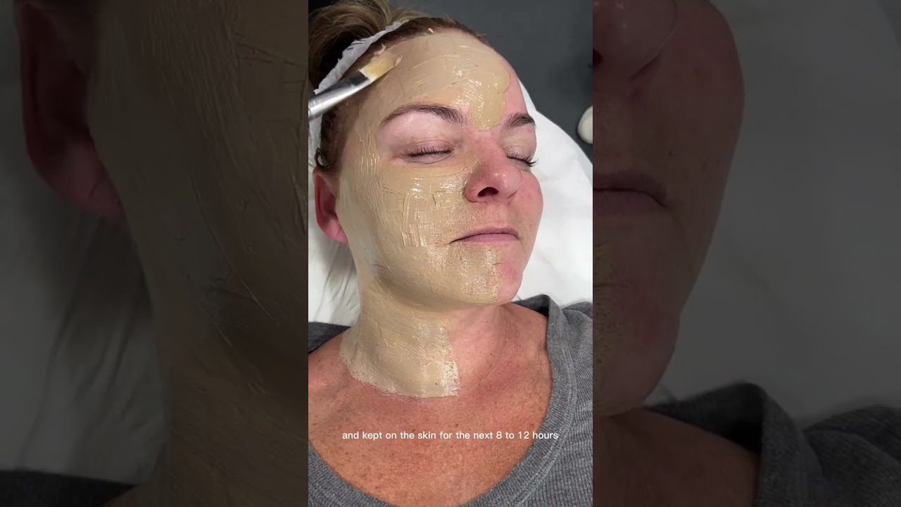 Do you have Melasma, Hyperpigmentation or Freckles? | Dr. Medispa