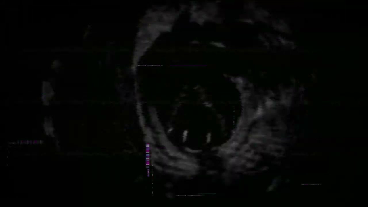 Hinn Chasing Music [ Psycho Mode ]