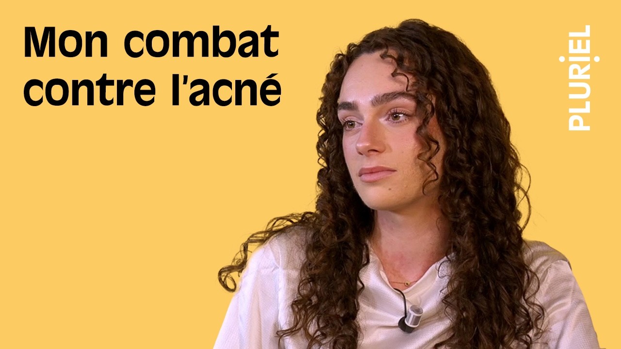 Acné et SOPK : “J’ai l’impression d’être défigurée”