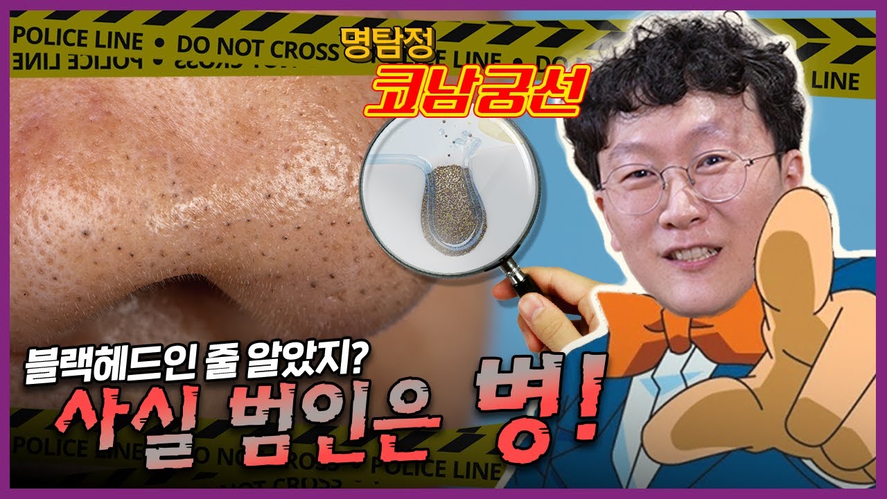 모공 속 까만 점의 정체, 충격적인 진실😱