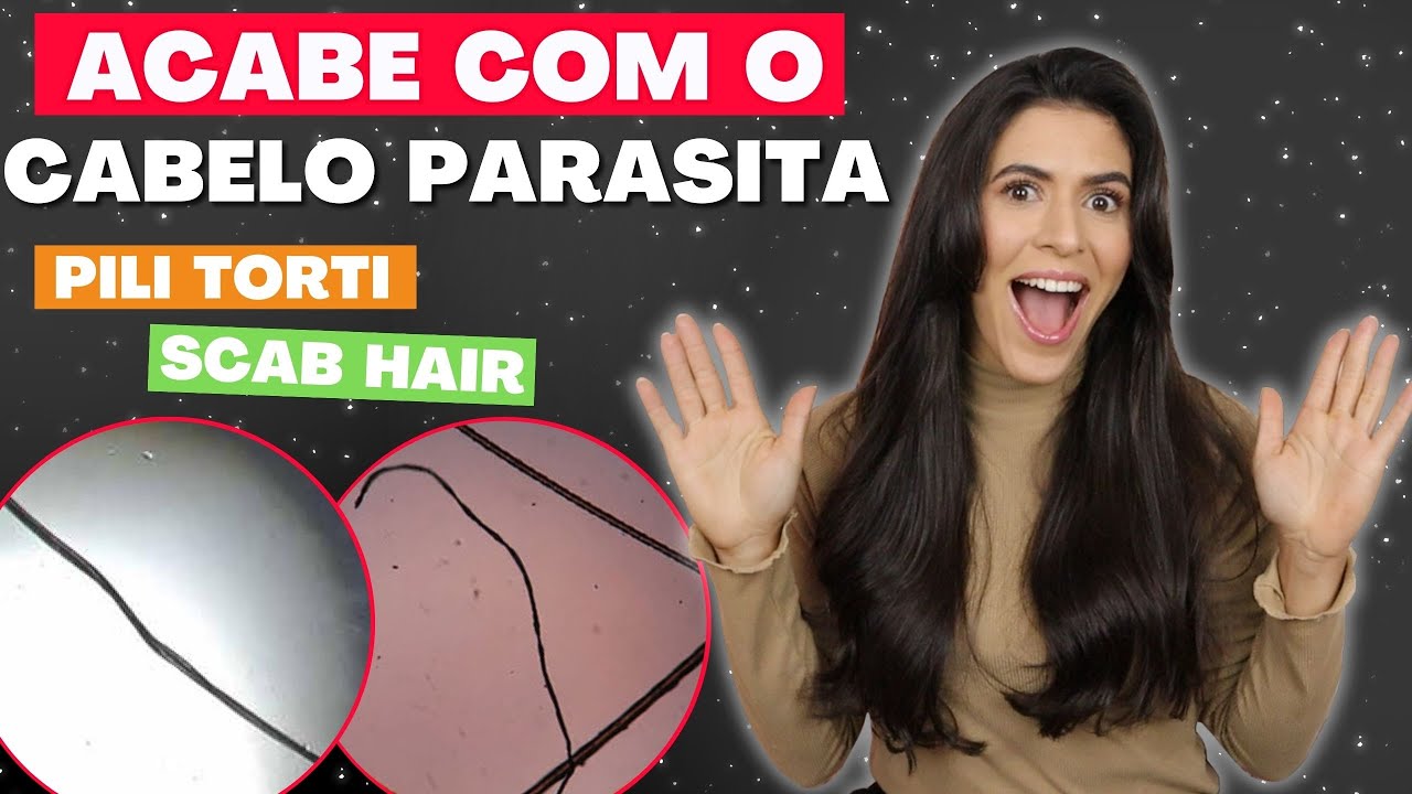 5 DICAS PARA TRATAR SCAB HAIR: OS FIOS PARASITAS TÊM SOLUÇÃO! | Larisse Gama