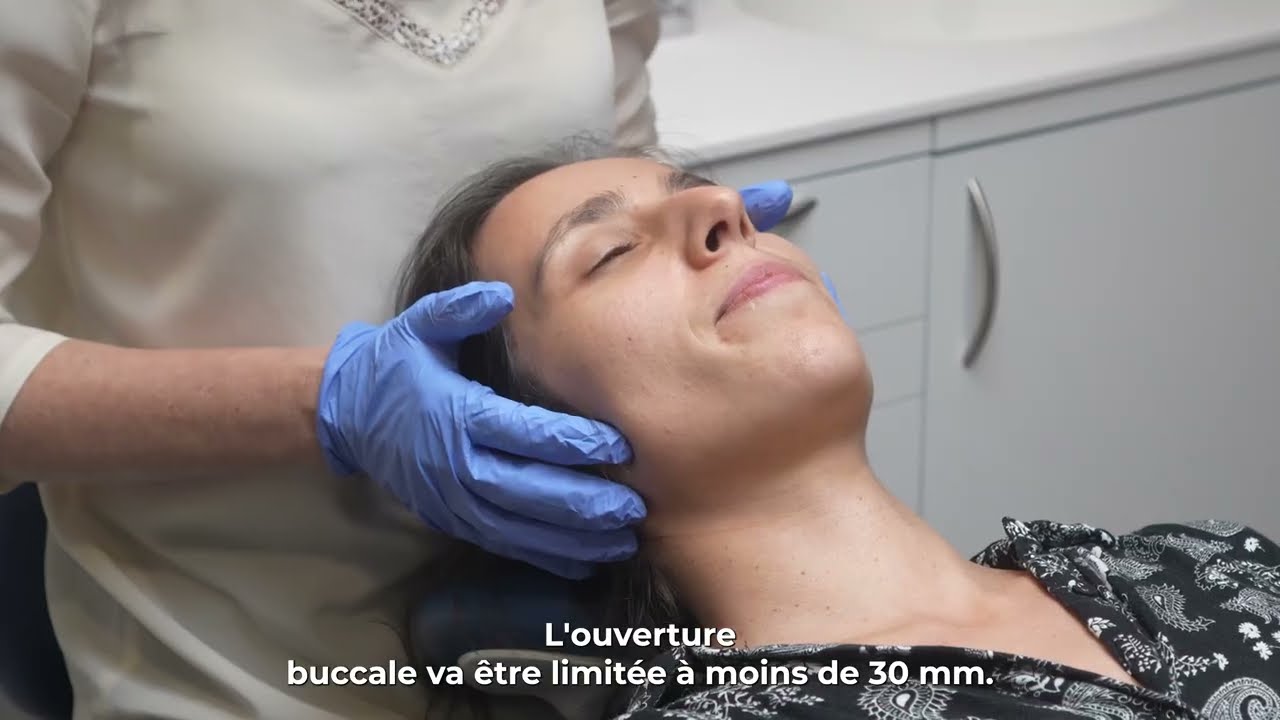 les limitations récentes de l’ouverture buccale liées à un déplacement discal non réductible #DTM