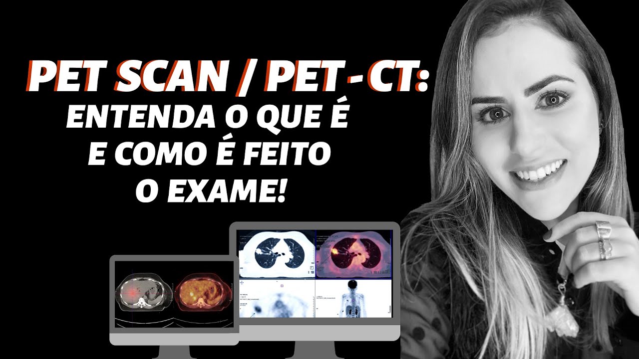 PET SCAN/PET-CT: ENTENDA O QUE É E COMO É FEITO O EXAME! - POR DRA. LÍVIA GRAVINA