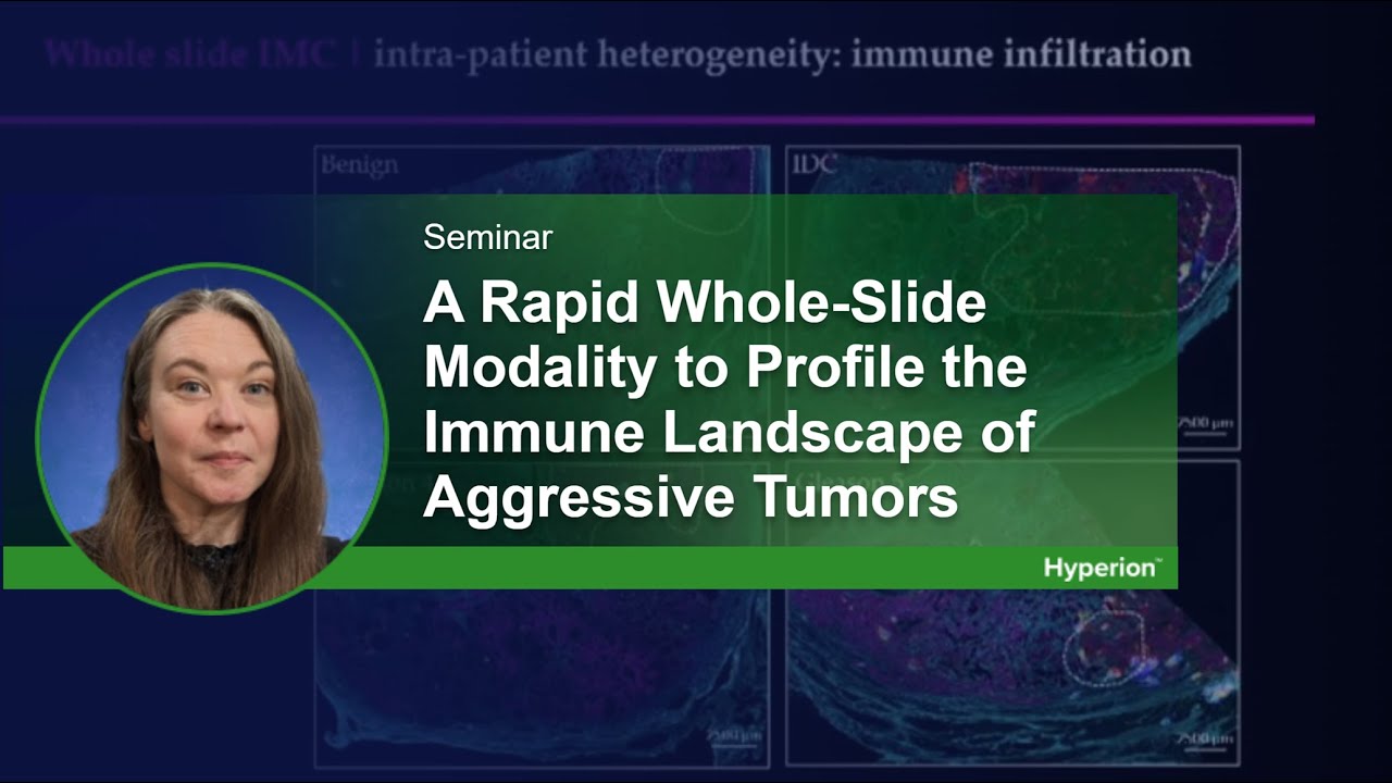 A Rapid Whole-Slide Modality to Profile the Immune Landscape of Aggressive Tumors