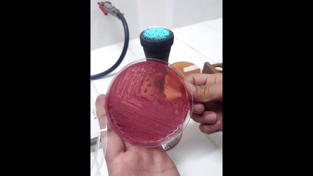 Análisis Microbiológico del Agua