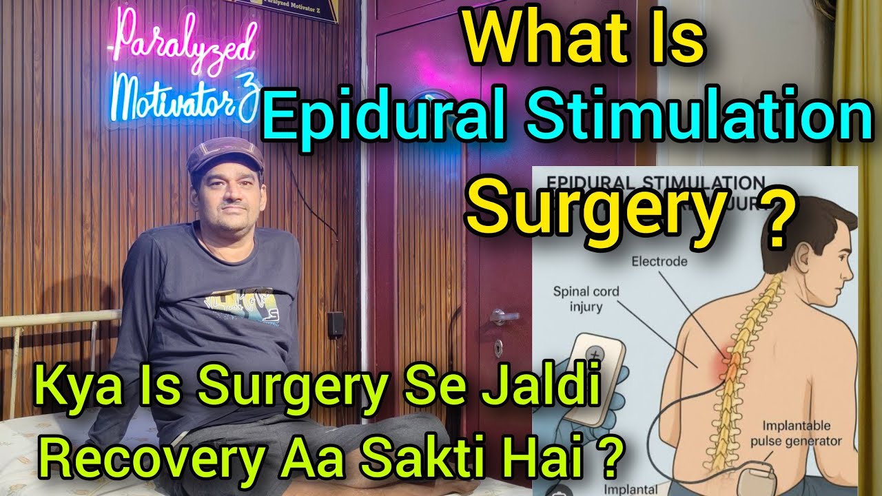 SCI Epidural Stimulation Surgery Kya Hoti Hai Kya Is Ko Karne Se Recovery Jaldi aa Jati Hai?
