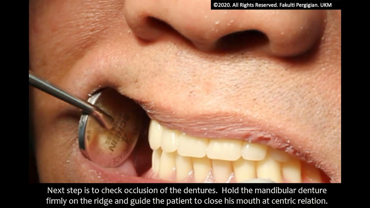 6 Complete denture construction-  Delivery denture