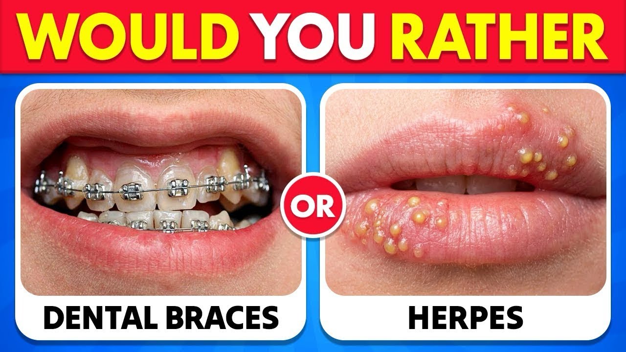 Would You Rather….? 😨 The Most Extreme Choices Ever | Easy to IMPOSSIBLE