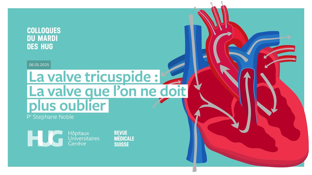 Colloque HUG ¦ La valve tricuspide: celle qu'on ne doit plus oublier - Pr Stéphane Noble