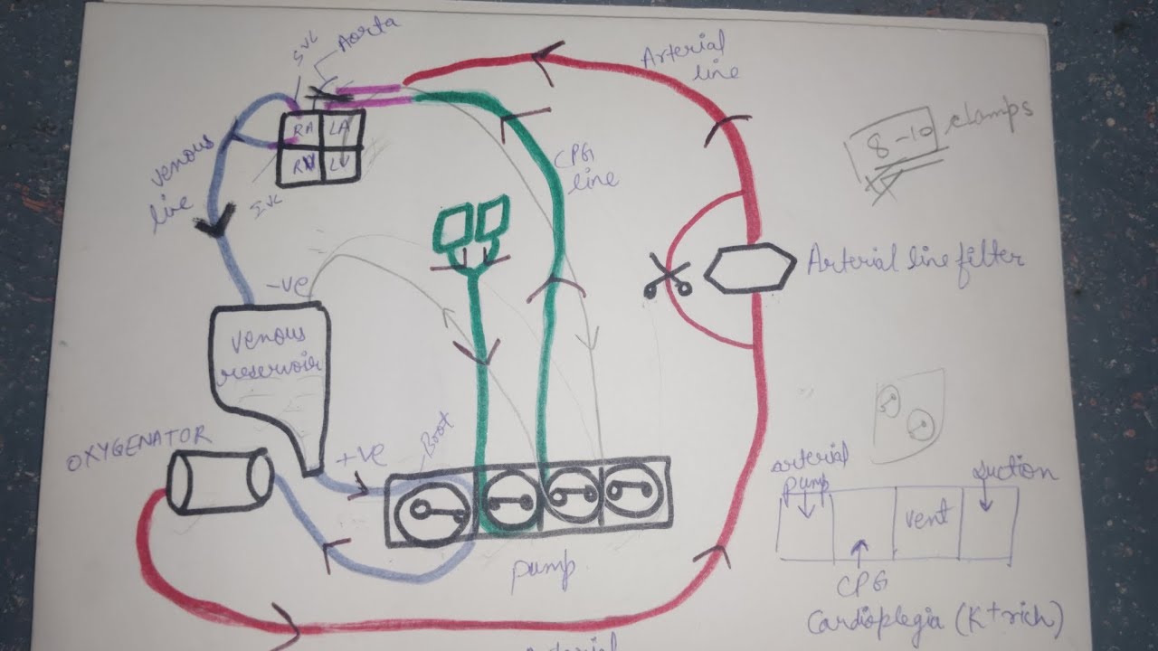 Cardiopulmonary bypass | CPB circuit | heart surgery #cardiology #cardiopulmonary #cpb #medical