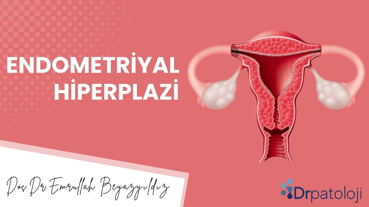 Endometriyal Hiperplazi