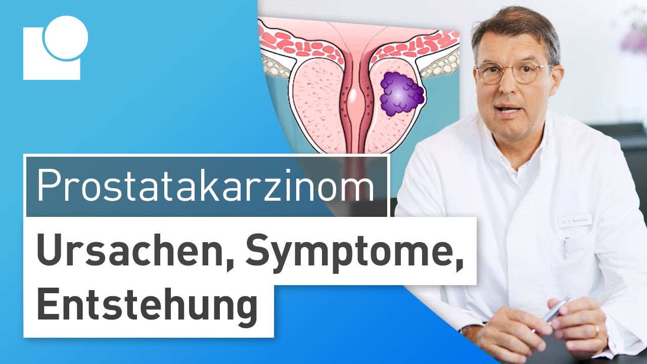 Prostatakarzinom einfach erkl&auml;rt: Entstehung, Symptome & Risikofaktoren | Prostatakrebs