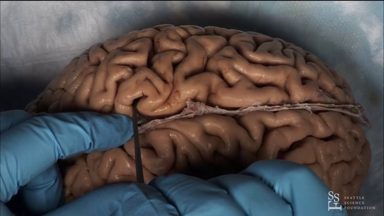 Lab Demo - Practical Anatomy of the Brain Sulci & Gyri by Guilherme Carvalhal Ribas, M.D.