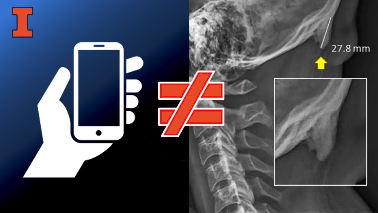 Are cellphones causing people to grow horns?
